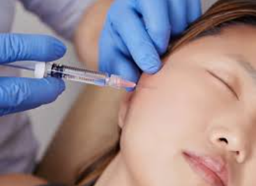 Injectable Profhilo Treatment: Benefits for Younger-Looking Skin